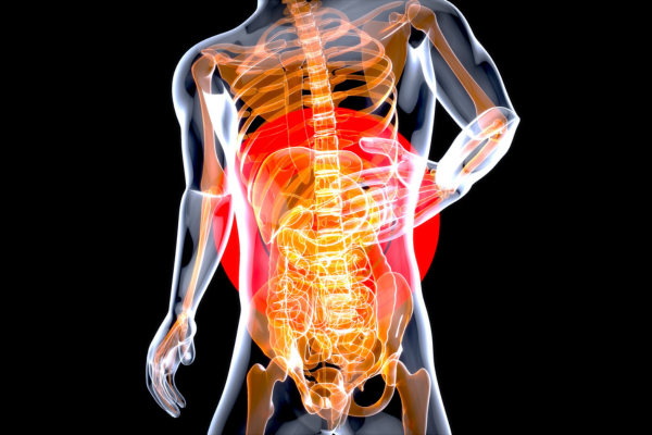 Stomach Cancer